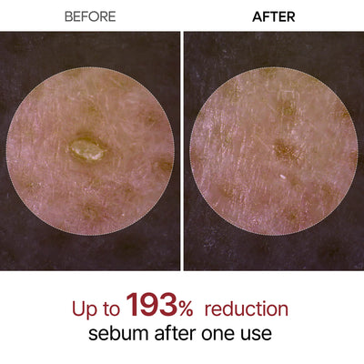 The Original Peel Shot