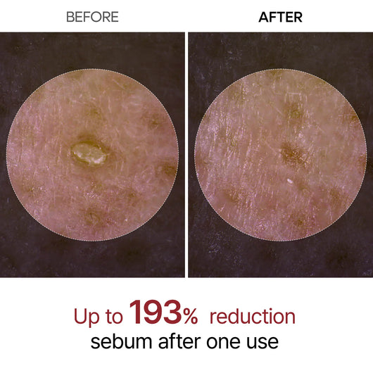 The Original Peel Shot