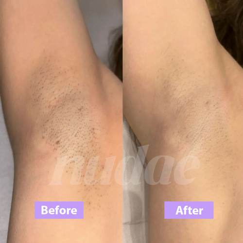 Nudae Cyperus Rotundus Oil