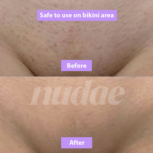 Nudae Cyperus Rotundus Oil