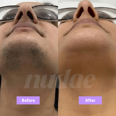 Nudae Cyperus Rotundus Oil