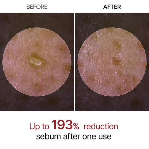 The Original Peel Shot