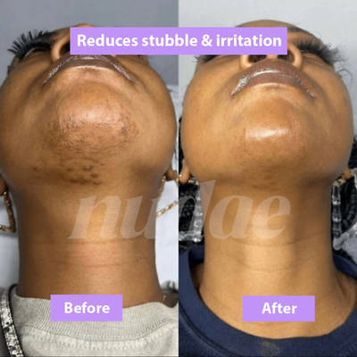 Nudae Cyperus Rotundus Oil