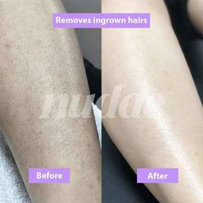 Nudae Cyperus Rotundus Oil